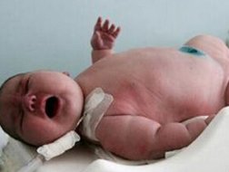 世界上出生最重的婴儿，澳大利亚产妇诞下37斤巨
